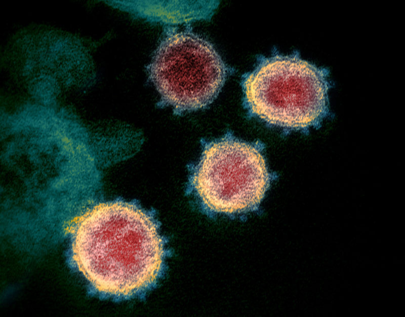 Covid-19 virus electron microscopy image